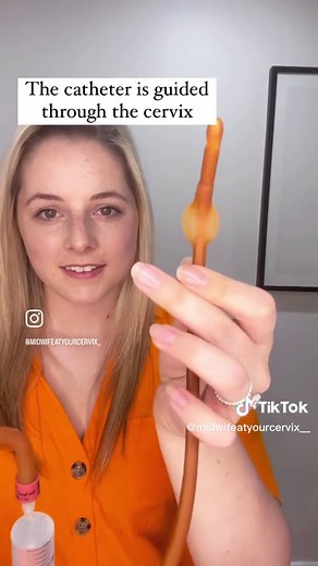 Medical Induction Process Explained: Balloon Catheter Edition