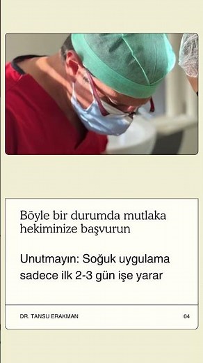 20'lik Diş Çekimi Sonrası Şişlik #dentist #dişhekimi #çenecerrahisi