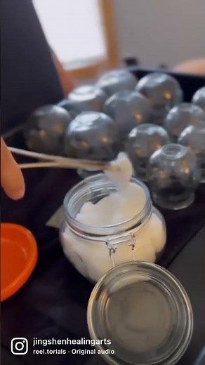 FIRE CUPPING THERAPY