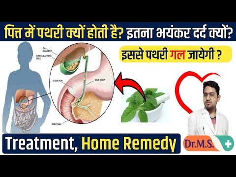 Gallbladder Stone (gallstones) | Symptoms, Causes, Treatment & Diet | gallstones symptoms