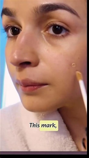 Picking Pimples Gave Her a Stubborn Dark Mark 😳 Don’t Make This Acne Mistake!