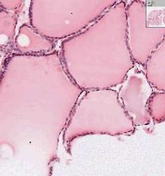 Shotgun Histology Thyroid