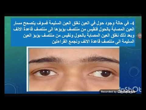 Medical Glasses - Inter Pupillary Distance (IPD).