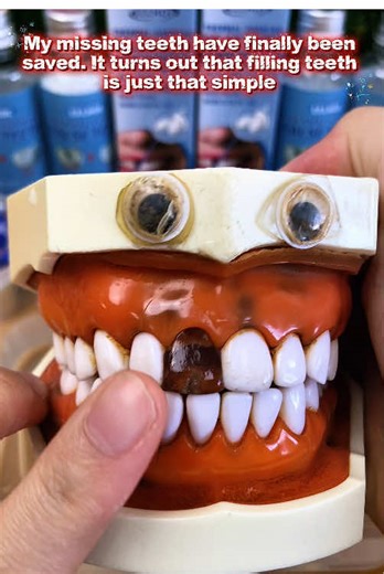 Simple Solutions for Missing Teeth and Fillings