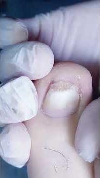 Master Linjiang's Secret Chi Techniques - Foot Care & Stress Relief