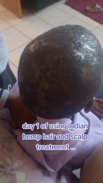Indian Hemp Hair Food and Treatment | Kuza Hair Growth Products