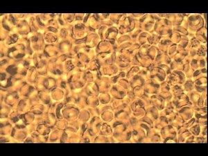 Nano motor en voyage through human blood