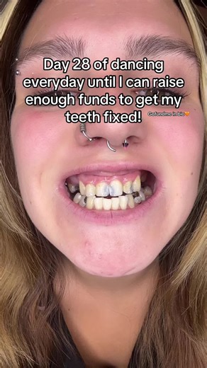 #surgery #teeth #help #dentist #donate