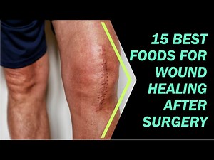 15 Best Foods for Wound Healing after Surgery