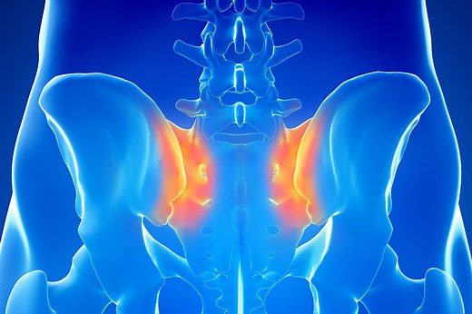 Rhume de hanche : symptômes, durée et traitements