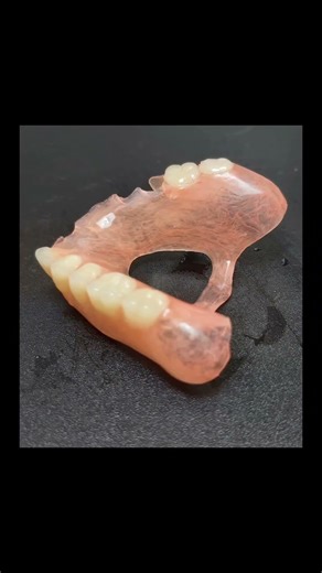 Πλαστικη οδοντοστοιχια κυπρος οδοντοτεχνικο εργαστηριο / Plastic denture _ dental cyprus