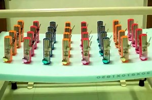 Watch 32 out-of-sync metronomes magically synchronize
