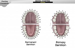 Dental Charting