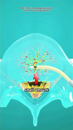 How Spinal Injection Is Given? (3D Animation)
