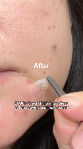 Cordiale Centella Pimple Patch #gifted #Cordiale #CentellaPimplePatch #CalmingComplex #kbeauty #acne