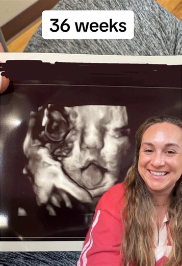 36 Weeks Pregnant: Exciting Ultrasound Update