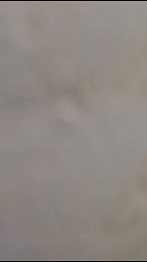 28K views · 224 reactions | Need a better understanding of lower back pain? Discover the basics of lumbar disc anatomy — how your spinal discs function, what causes disc bulges or herniation, and why proper posture matters. | Spine-health | Facebook