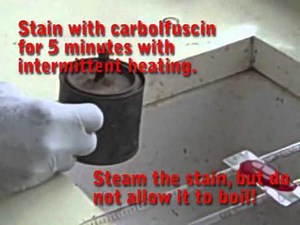 Preparing an Acid-Fast Stain using the Ziehl-Nielsen Method - Multi-Lingual Captions