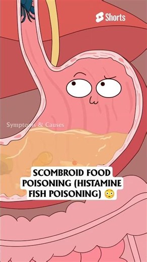 Can Dead Seafood Poison Your Body? 😨 | Histamine Food Poisoning | Crab Warning #shorts