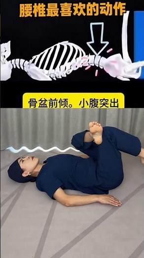Fix Pelvic Tilt & Lower Back Pain - Easy Home Exercises