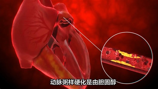 Nature子刊｜山大齐鲁医院张澄、张猛教授联合山大基础医学院高成江教授揭示RNF128在动脉粥样硬化中的关键角色