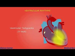 Ventricular Rhythms‪@medicalexcellencecenter‬