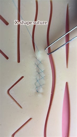 Essential Surgical Skills: Mastering Suturing Techniques