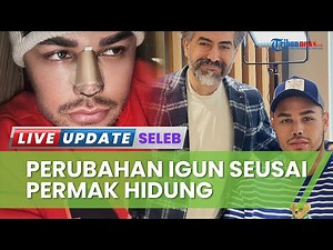 Jalani Oplas Bagian Hidung di Turki, Penampilan Baru Ivan Gunawan Dipuji Warganet: Kayak Barbie Ken
