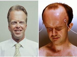 Who has the biggest forehead in the world? - Hedge the book