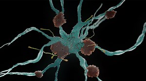 The Impact of a cholesterol-lowering medication on Alzheimer’s Disease