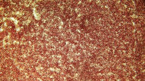 2.9K views · 50 reactions | Microfilariae, the infective larvae stage...