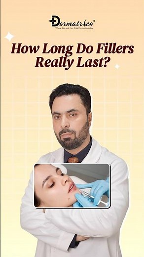 How Long Do Fillers Really Last? Lip, Cheek, Jawline & Under-Eye Explained