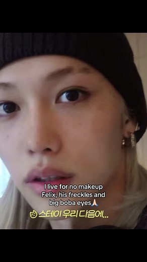 Felix: Embracing Natural Beauty | Kpop Idol Makeup-free Look