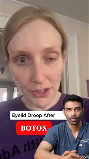 This Isn’t Botox Damage — It’s Ptosis | Doctor Breaks the Myth