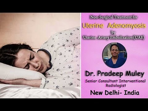 Non-Surgical Treatment of Adenomyosis