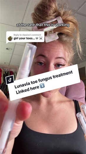 Effective Toe Fungus Treatment with Lunavia