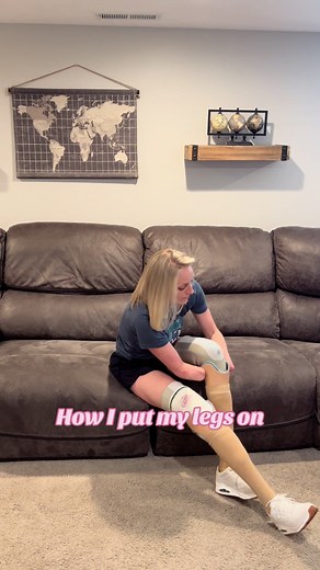 How to Put on Prosthetic Legs: A Guide for Amputees