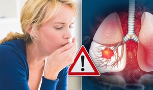 Lung cancer: Signs and symptoms to look out for