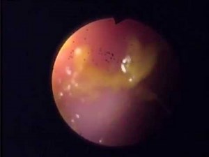 Gastroscopia y colonoscopia en perro con diarrea crónica