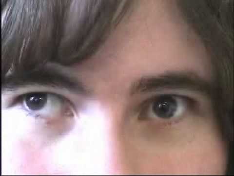 Abnormal cover uncover tests (3 cases)