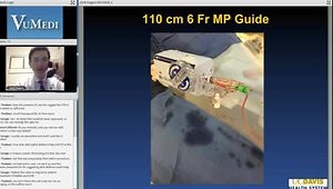 Residual Intraclip Mitral Regurgitation after MitraClip Procedure Treated with the Amplatzer Vascular Plug II