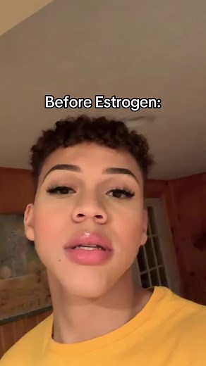 Journey of Transition: My Experience with Estrogen