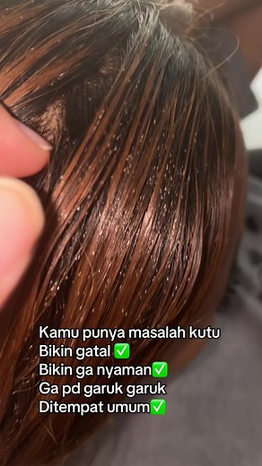 Treatmen kutu dan telur dijamin bersihhh🥰 #probolingo #probolinggo_jawatimur #kuturambut #obatkutu #salonprobolinggo