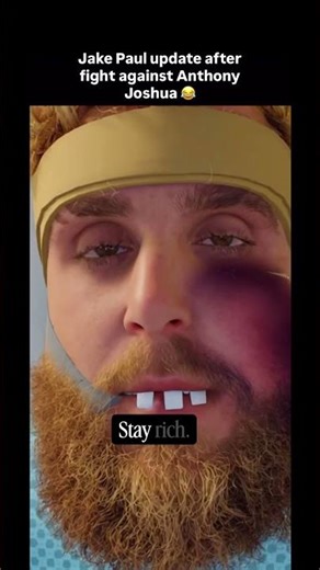 I lost the fight, but atleast I Can Get turkey teeth now 😂 #roblox #jakepaul #boxing #hospital