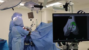 1K views · 12 shares | The Mako Robotic-Arm helps guide surgeon, Jeffrey Noblin, MD using 3D imaging technology. Resulting in less pain, shorter recovery time & smaller incisions for our patients. #improvehealth #savelives #tomorrowstechnologytoday Bienville Orthopaedic Specialists | Singing River Health System | Facebook
