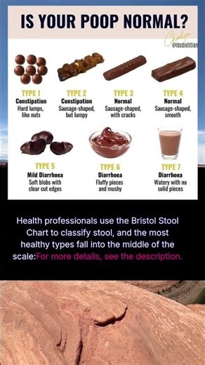 is your poop normal ?