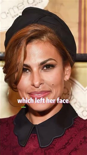 Have you noticed Ryan Gosling and his wife Eva Mendes' swollen faces?#ryangosling #evamendes