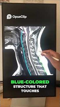 How to read Cervical spine MRI? #anatomy #radiology