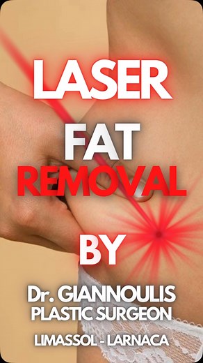 Laser lipolysis (SMART LIPO) is a minimal-invasive form of body...