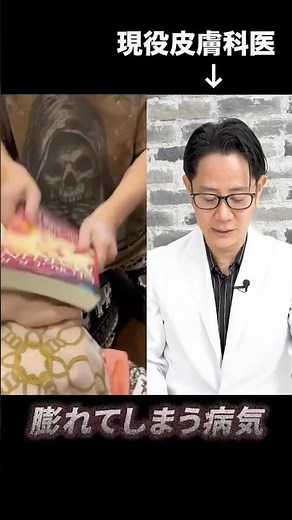 Can ganglion cysts be cured by yourself? A dermatologist explains #shorts